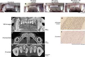 Anti-USAG-1 therapy for tooth regeneration through enhanced BMP signaling